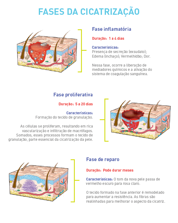 Como Acelerar a Cicatrização da Pele?