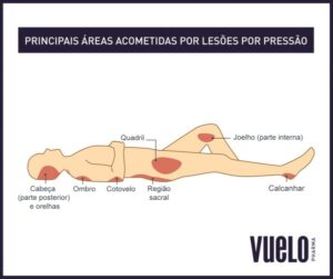 Principais pontos lesões por pressão
