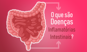 Doenças inflamatórias intestinais