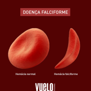 Hemácia normal e hemácia falciforme