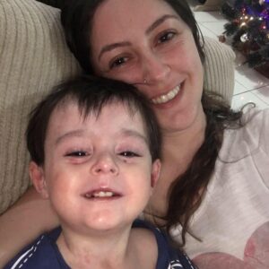 Conte sua história: mãe de EB membracel, epidermólise bolhosa, lesão de pele