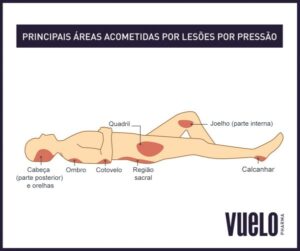 Lesões por pressão (escaras): como tratar? Regiões suscetíveis à escaras