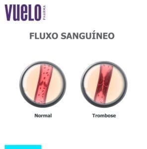 Úlcera varicosa e trombose Ilustração de trombose