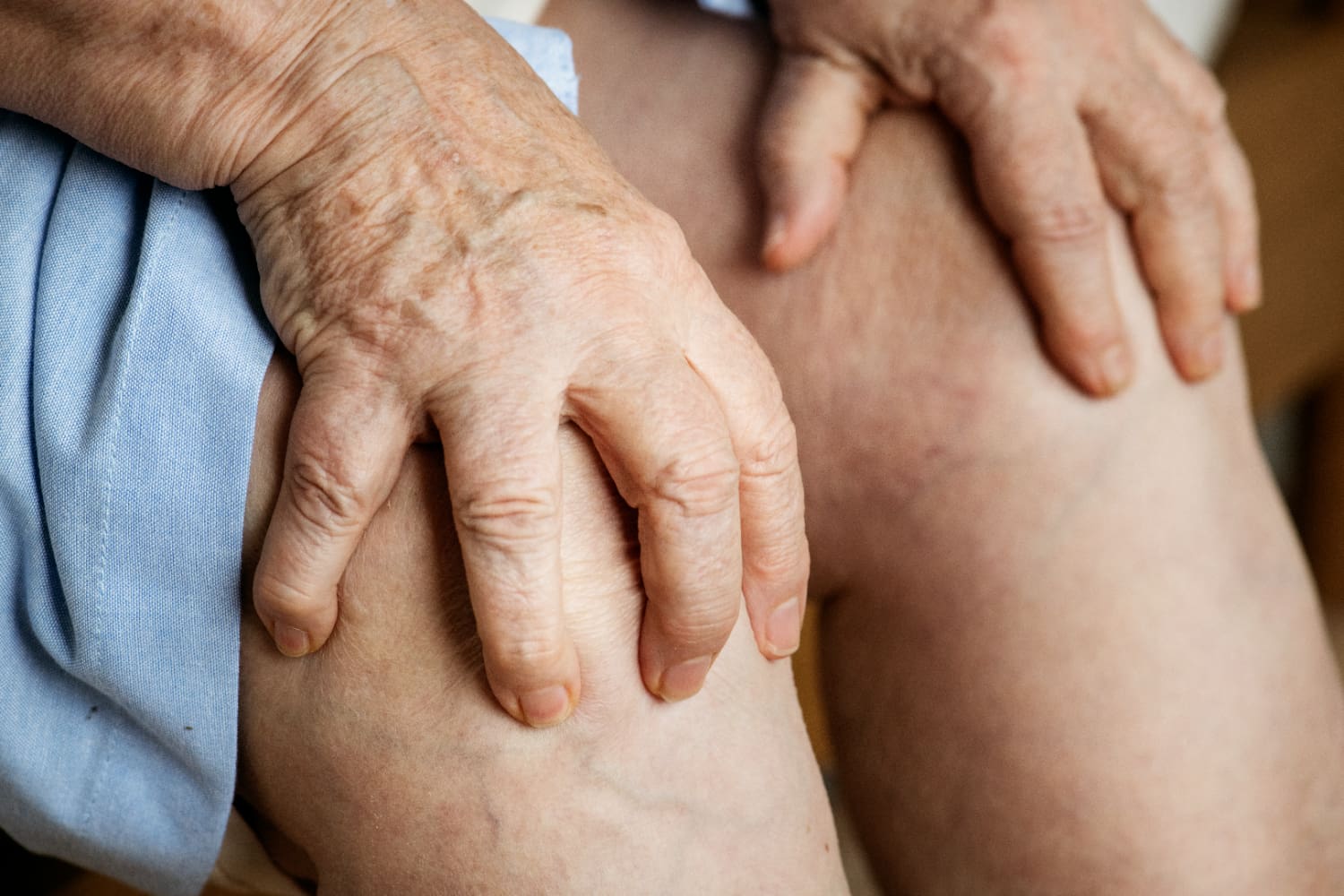O Que é Trombose? Sintomas e Cuidados para Prevenção