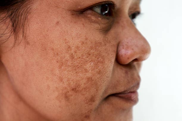 Doenças de Pele: Causas, Tratamentos e Prevenção