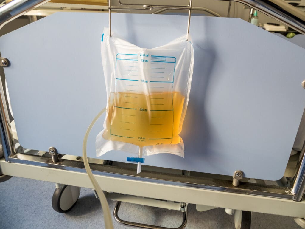 O que é ostomia? Tipos, cuidados e adaptação