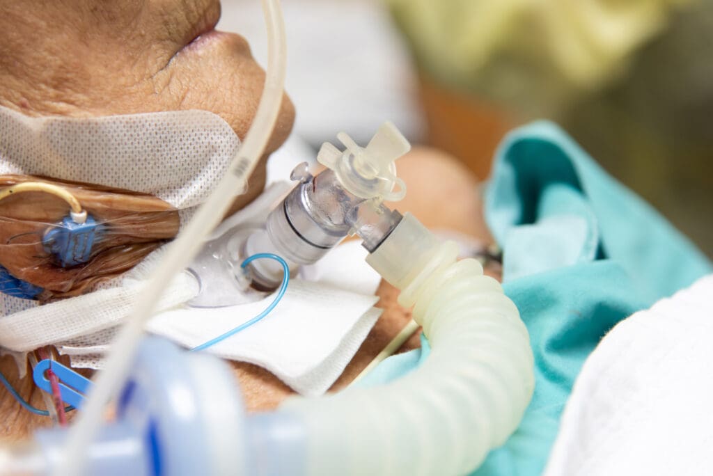 O que é ostomia? Tipos, cuidados e adaptação