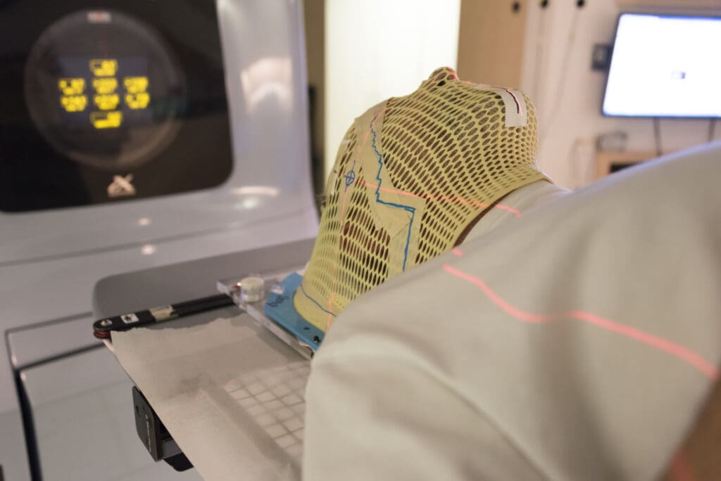 Melanoma: O Que É, Sintomas e Como Identificar
