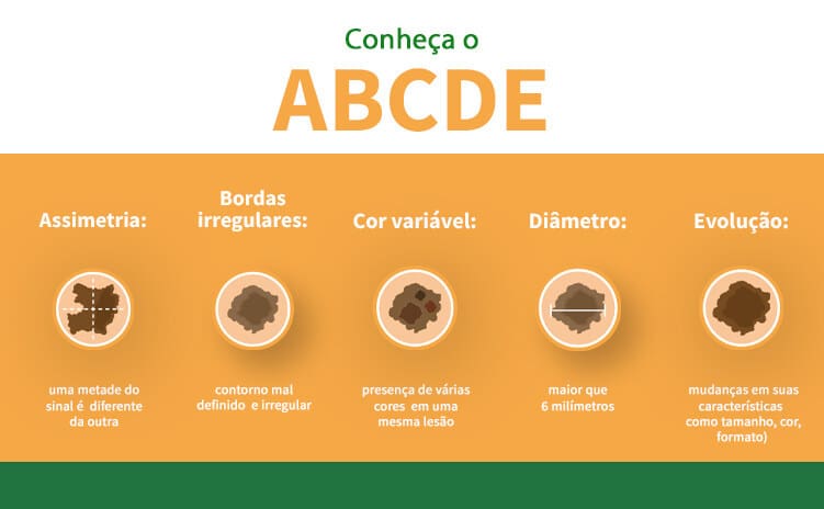 Tipos de Câncer de Pele: Sintomas, Diagnóstico e Tratamento