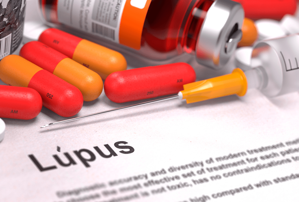 Lúpus Eritematoso: O que é, sintomas e tratamento