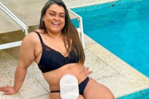 A coragem de Preta Gil e os cuidados essenciais com a pele após o câncer