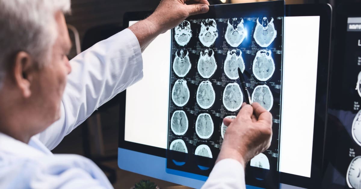 O que é oncologia? Saiba o que faz um médico oncologista