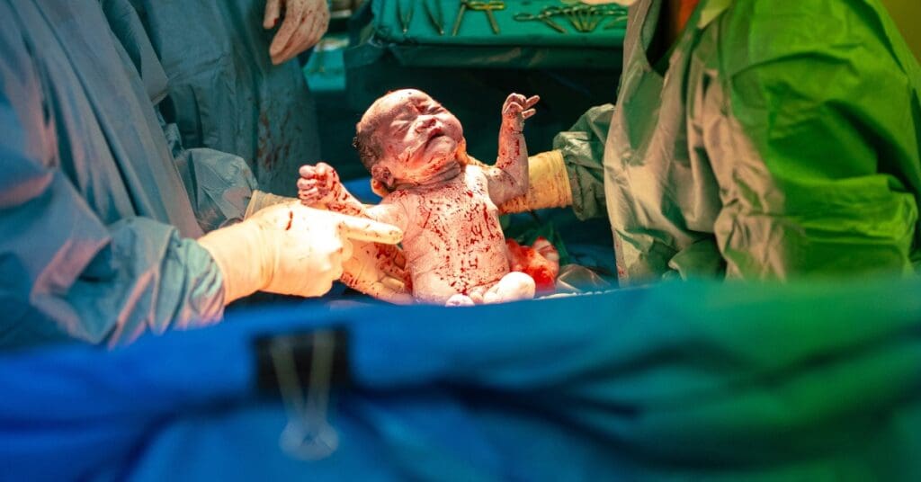 Incontinência urinária de esforço: o que causa o escape de urina ao tossir e como tratar