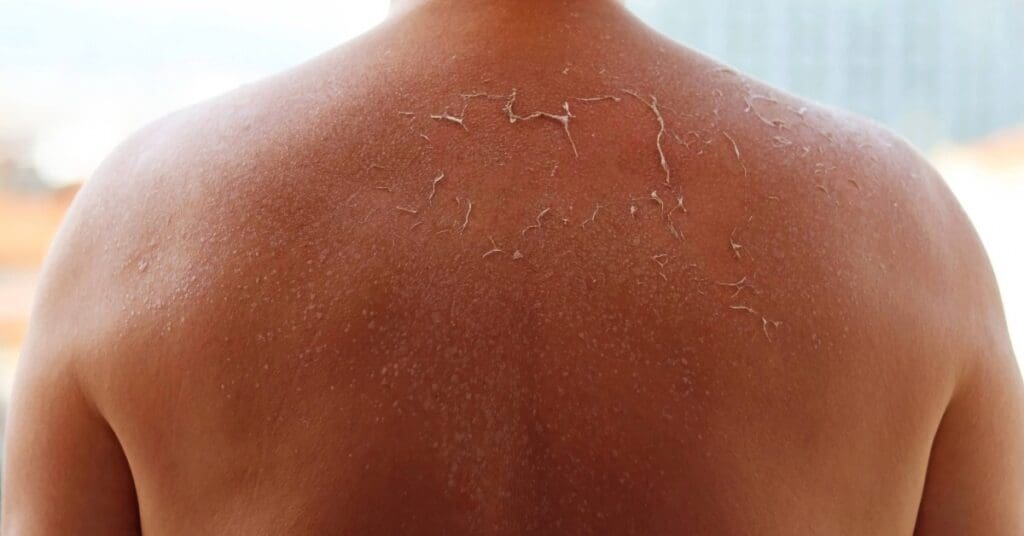 Pintas na pele: o olhar atento que faz a diferença