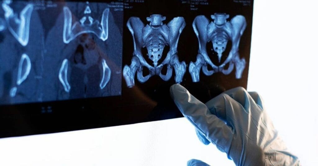 Proctologista: o que faz, quando procurar e principais doenças tratadas