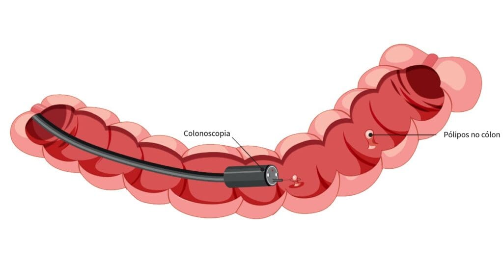 Proctologista: o que faz, quando procurar e principais doenças tratadas