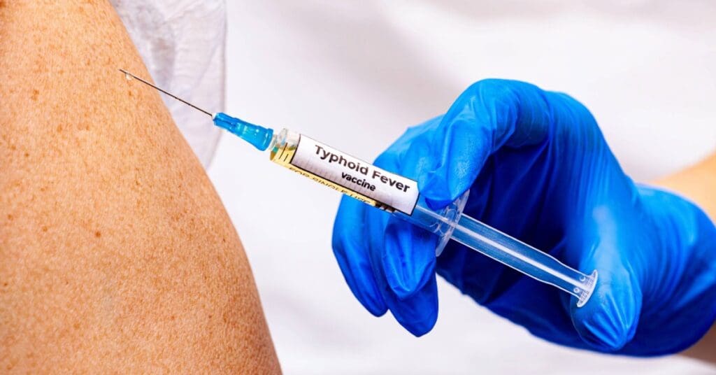 O que é vasculite cutânea? Conheça os sinais e como tratar