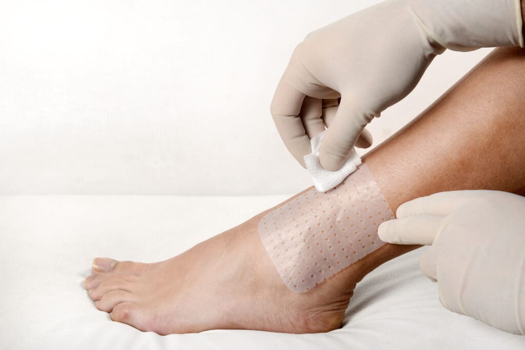 Saúde Vascular: como prevenir doenças circulatórias