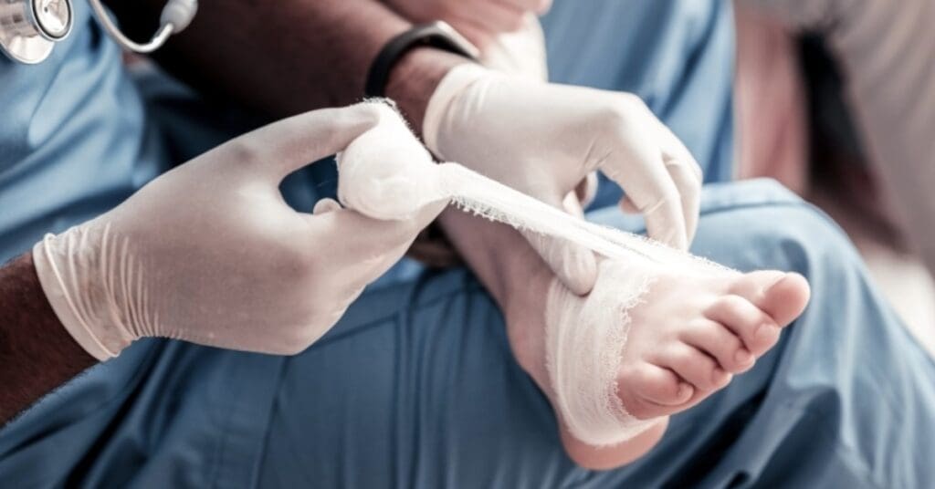 Úlcera de Marjolin: entenda a transformação de feridas crônicas